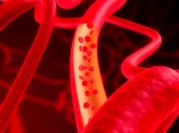 Why Your Blood Test Results Should Be Personalized to You